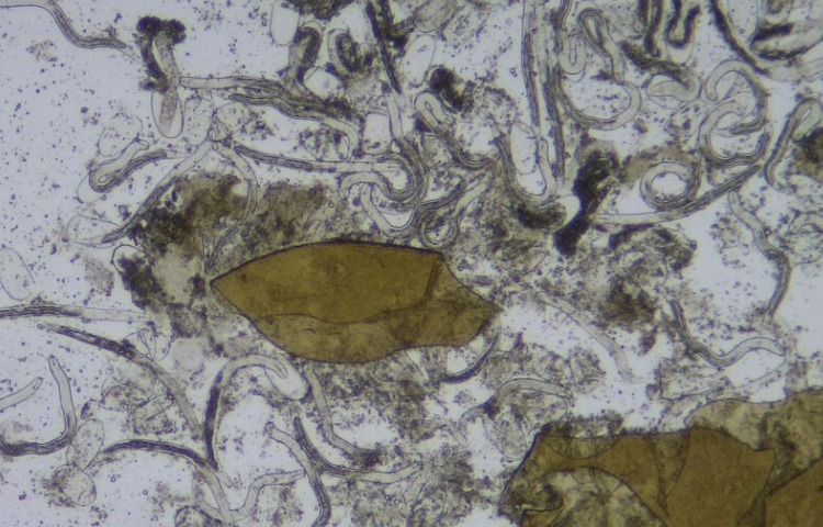 Nematodes under microscope