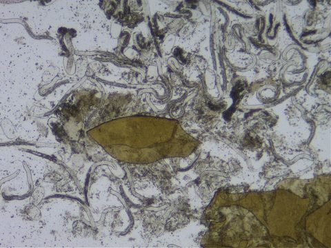 nematodes under the microscope