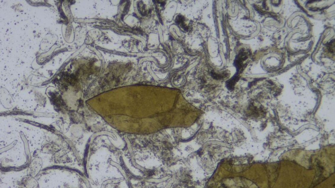 Nematodes under microscope