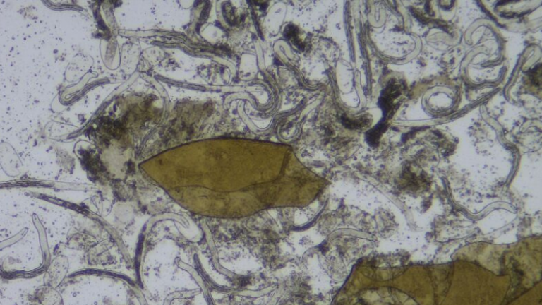 Nematodes under microscope